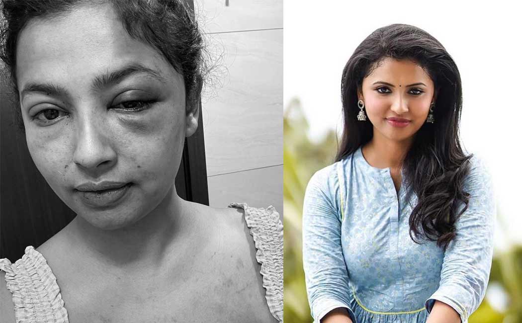 actress anicka vikramman ex boy boy friend issue