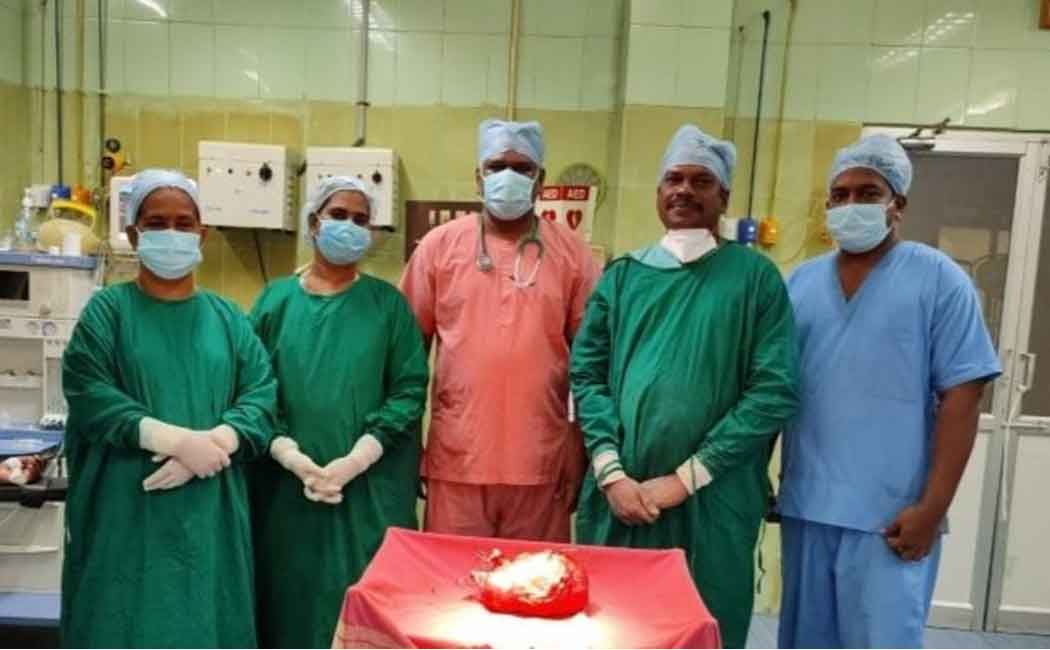 Government doctors successfully removed 6 kg tumor from the woman's stomach