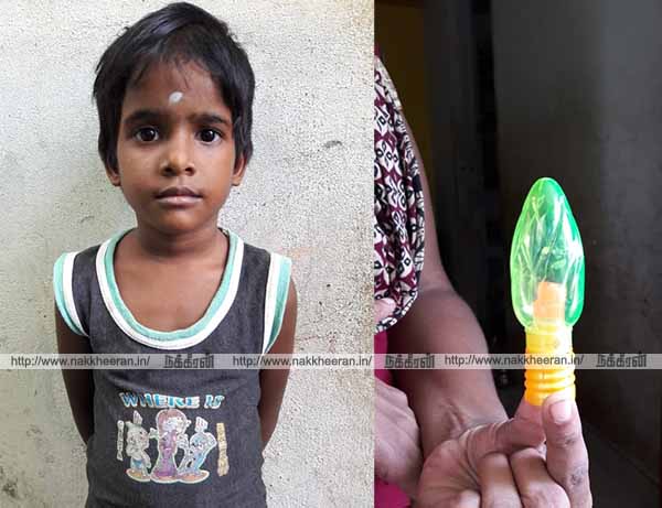 Go to the baby's stomach battery! Government hospital that ignores: 'lipstick candy' disaster .. !!