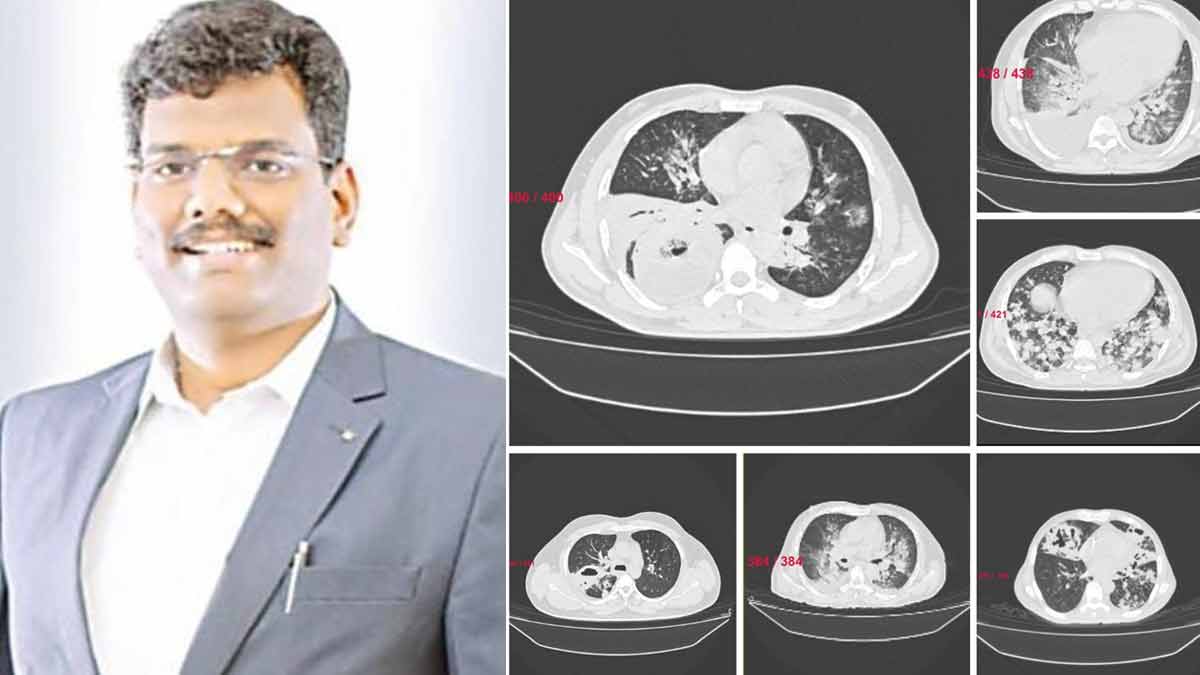 'New Lung Diseases Caused by Climate Change' - Doctor's Advice to Stay Safe
