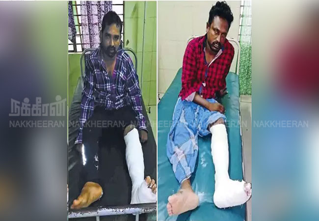 salem gold chain thief incident in two wheeler admit hospital police