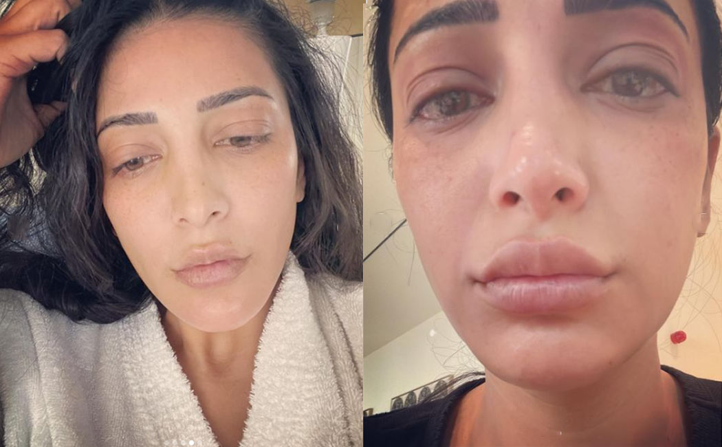 shruthi hassan post makes fans shock