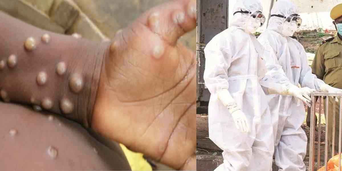 Monkey measles in Kerala?- Shock!