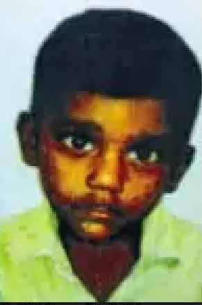4-year-old boy dies for Diphtheria fever in Salem