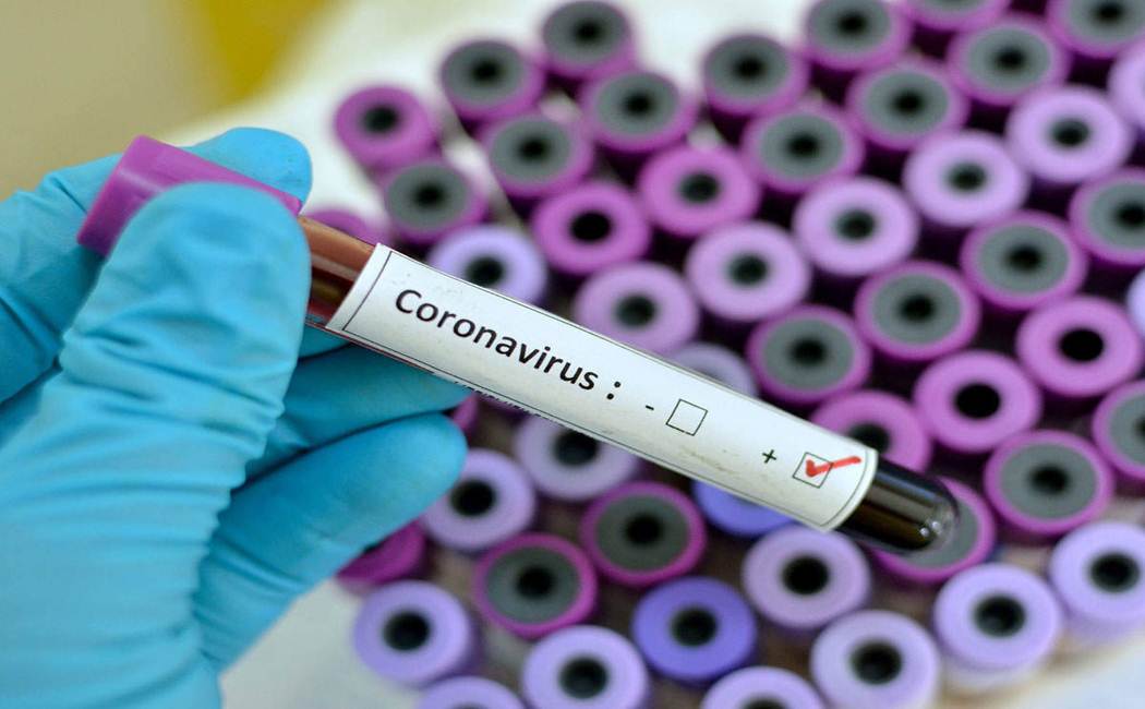 Tamilnadu corona virus updates - April 24
