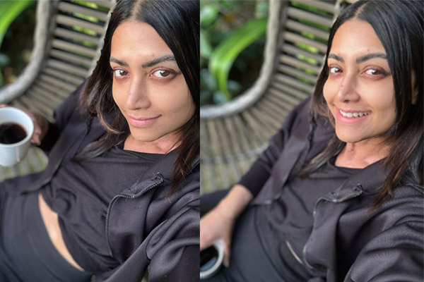 Mamta Mohandas suffering from new type of disease