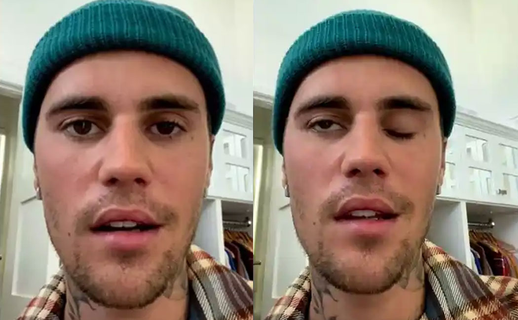 Justin Bieber cancels justice world tour shows after half face left paralysed virus