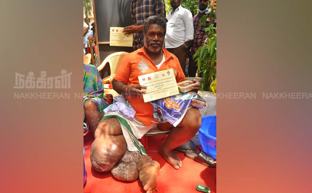 Health Minister Ma Subramanian presented scholarships affected elephantiasis
