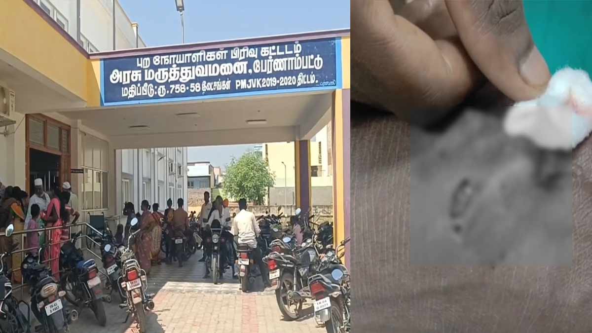 Stray dogs biting; 7 people were injured