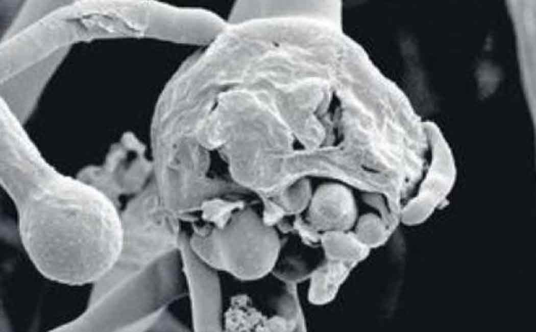 Medicine shortage for fungal diseases - relatives of patients suffering ..!