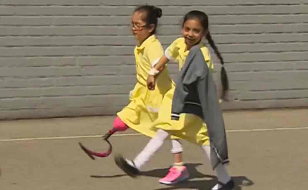 school girl enjoyed with friends after getting artificial leg