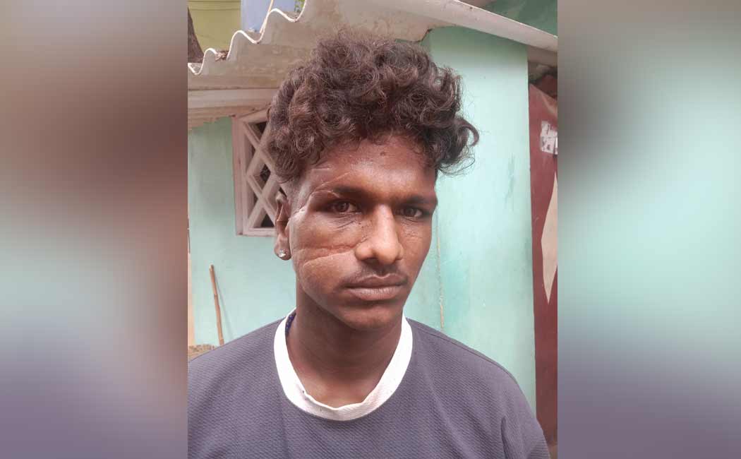Human rights activists comments against police shot and caught criminals tamilnadu