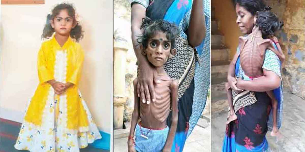 '' The health of little Ishaqiyammal is improving '' - Interview with Minister Ma Subramanian