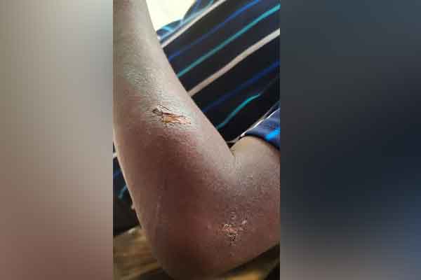 Relationship beyond marriage; The mother who tortured her son