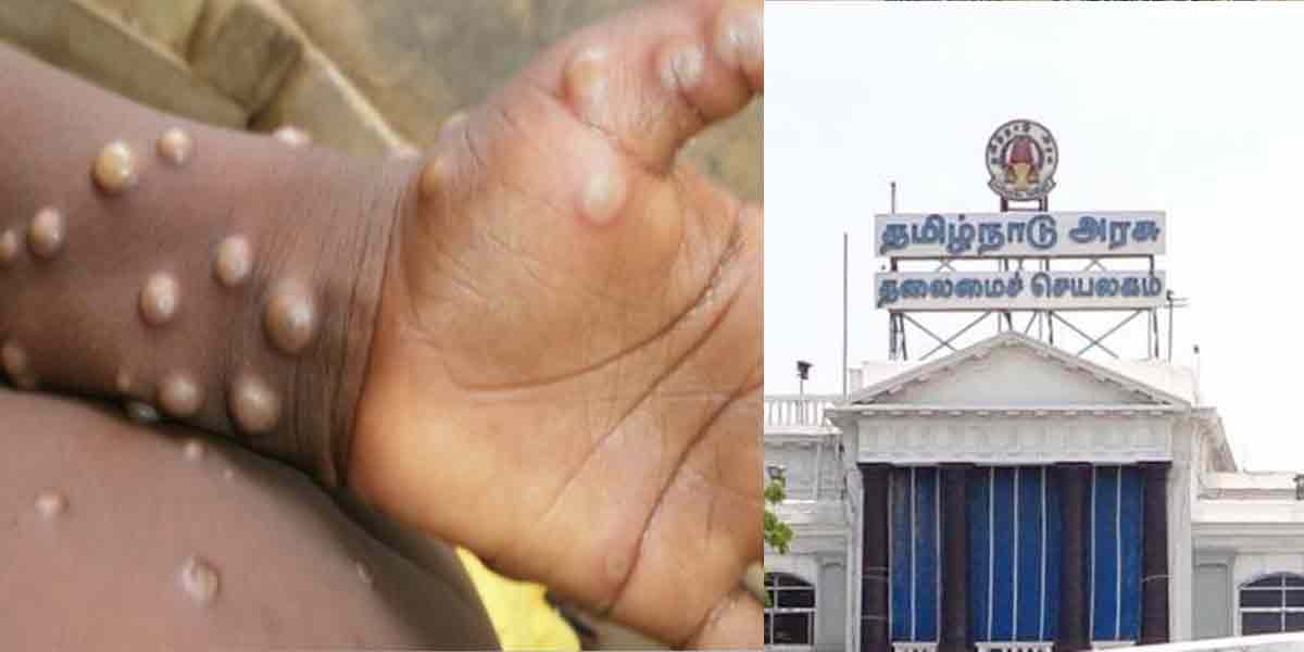 Monkey pox spread ... Tamil Nadu government announces emergency!