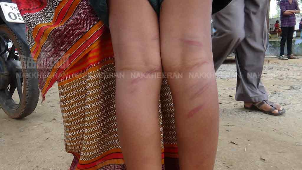 Action against teacher who hit the student
