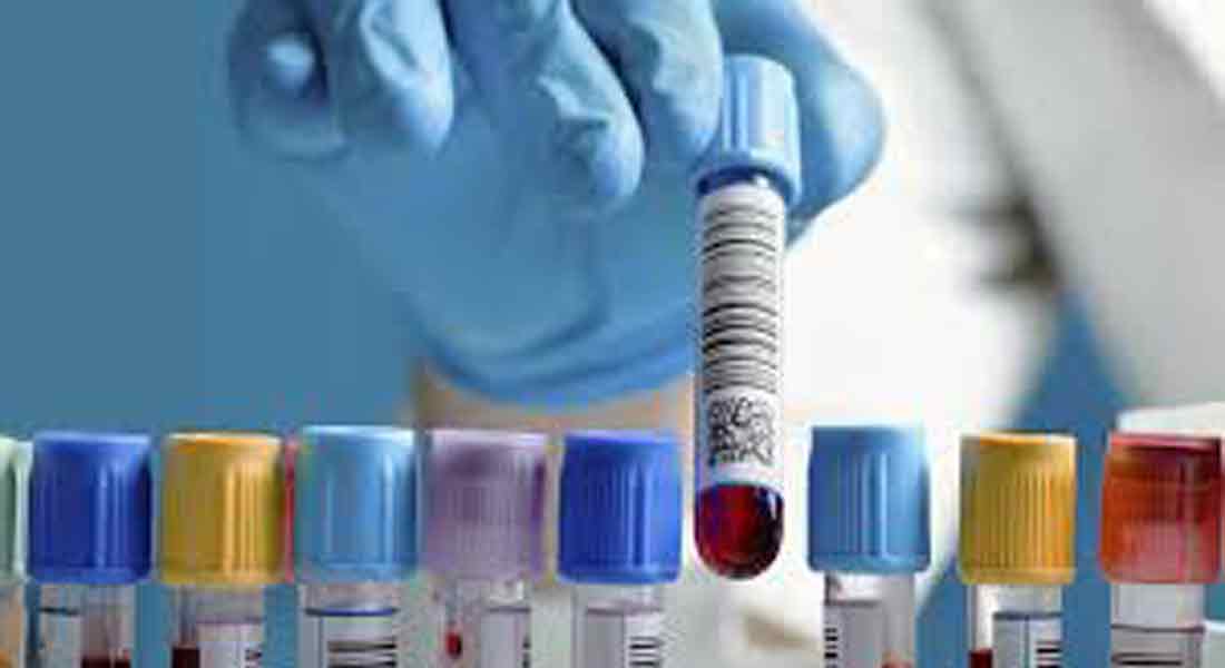 Court order for Corona to take preventive treatment at a cost of 2 rupees
