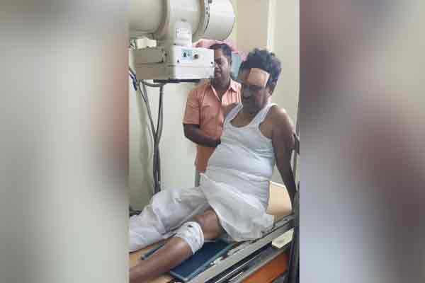 Congress Committee President fell and injured in walking