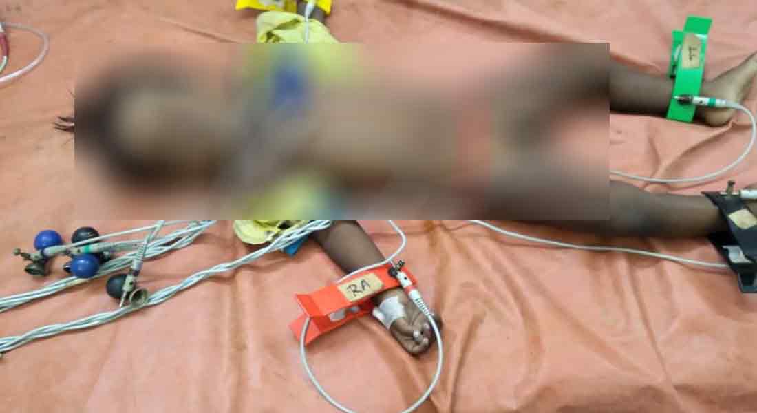 2 year old baby dies after eating rat killing biscut of as biscuits