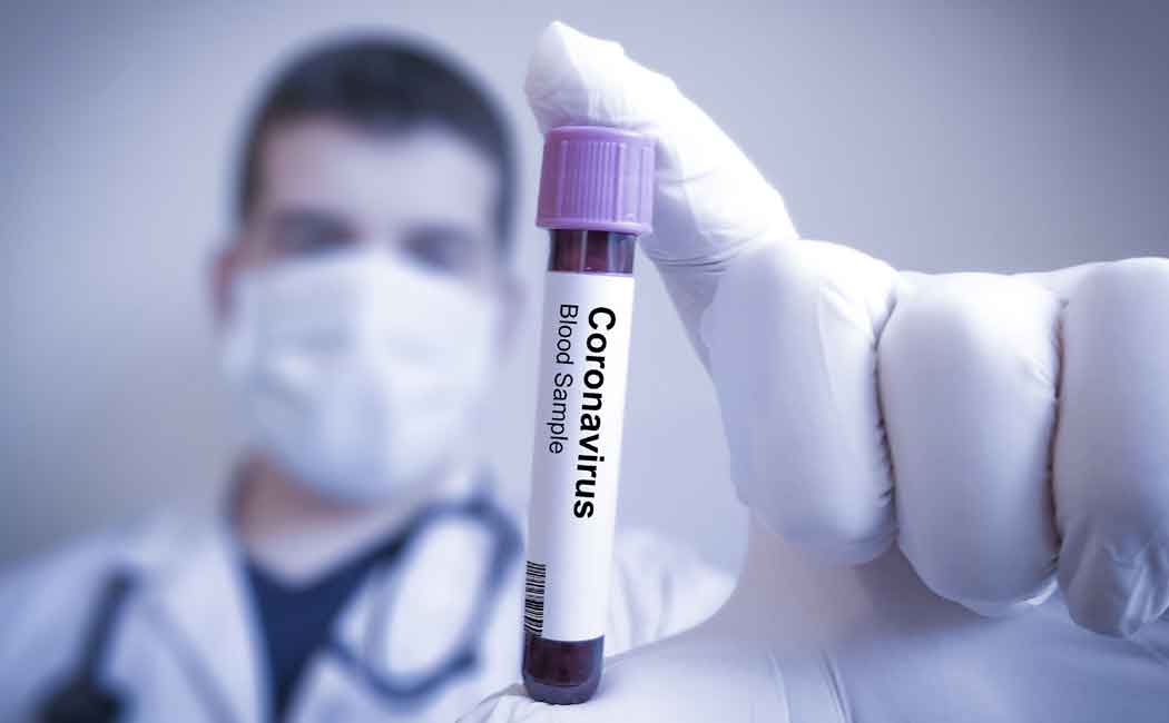 "Results will be released in the next 30 days" - Health officials announced