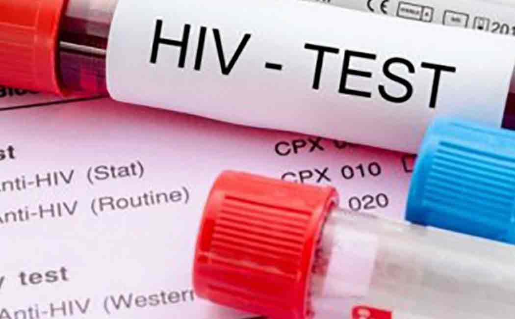 doctor misdiagnoses aids test in simla