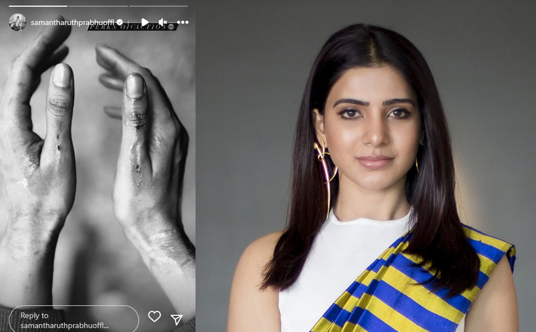 samantha hand injury while workout