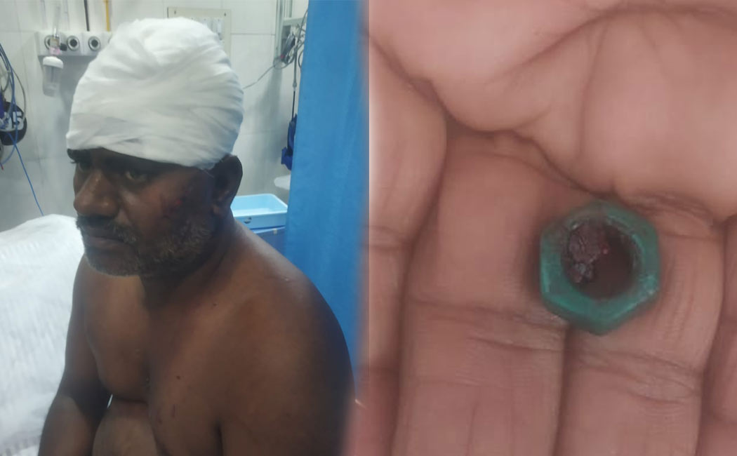 Doctors put bolt head person who came treatment government hospital and stitch it