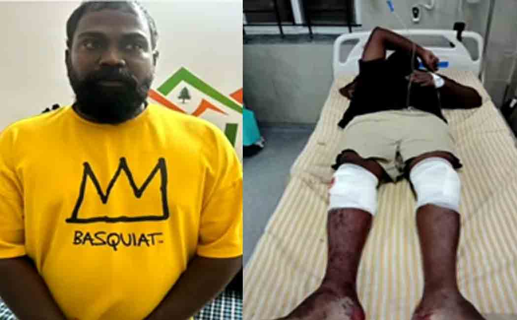 Action taken by the police for a famous rowdy who was absconding in a case