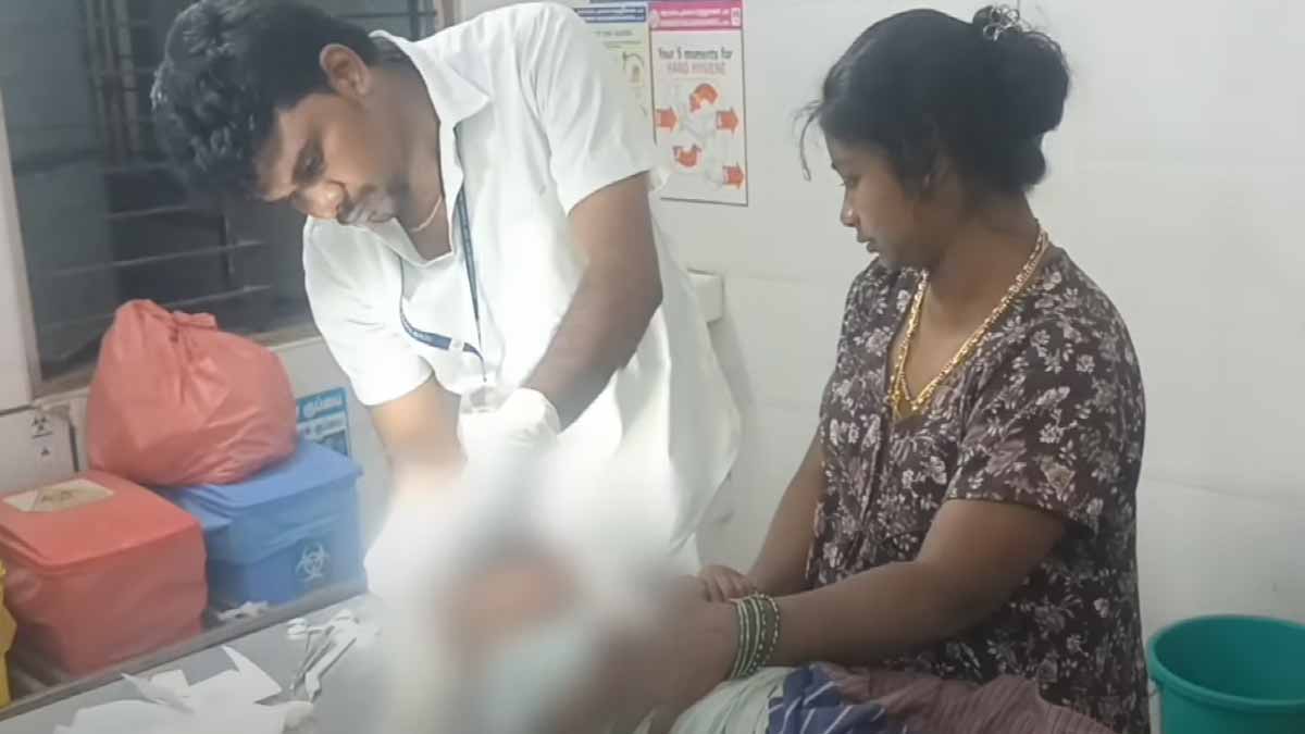 Stray dog bites and mauls 3-year-old child