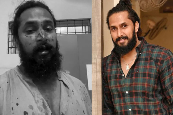 kannada actor Chetan Chandra seriously injured in mob attack