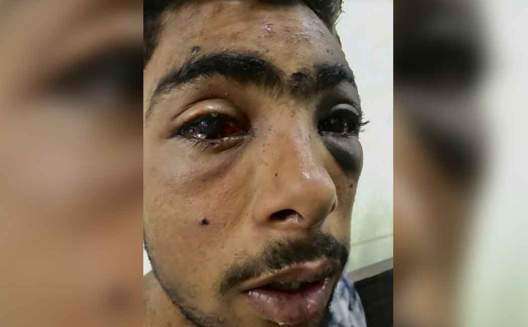 pellet kashmir
