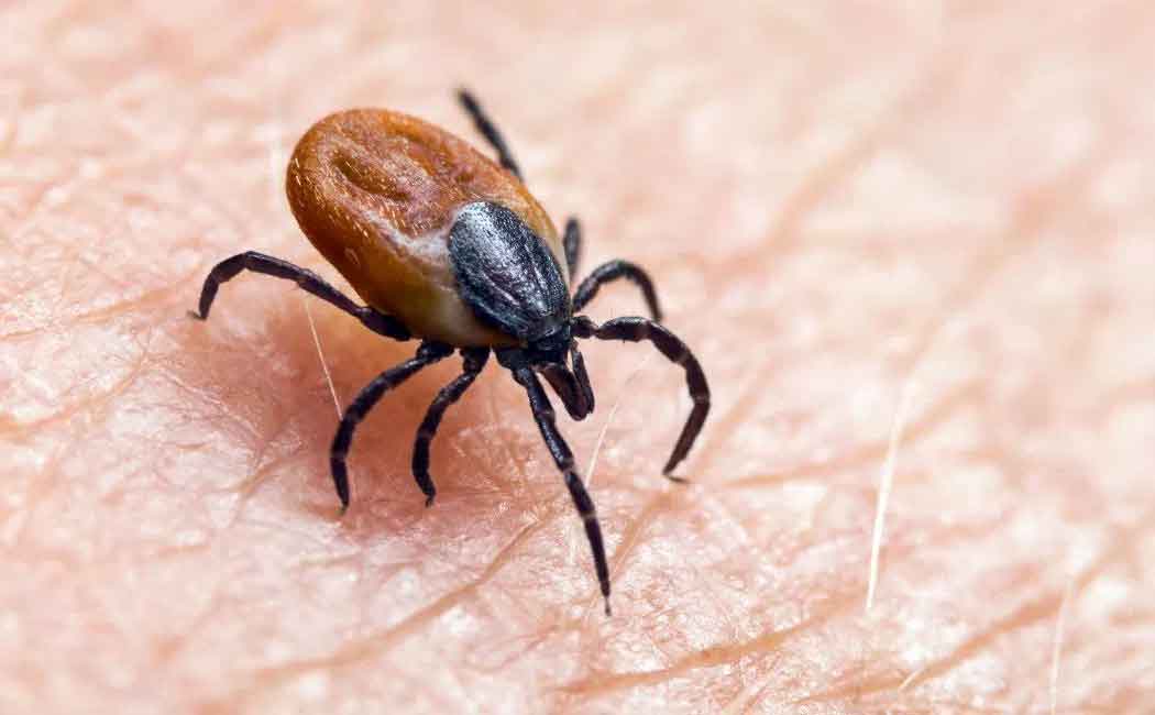 lyme disease