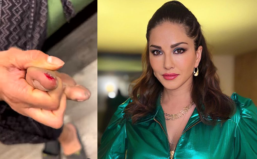 Sunny Leone Injured in shooting