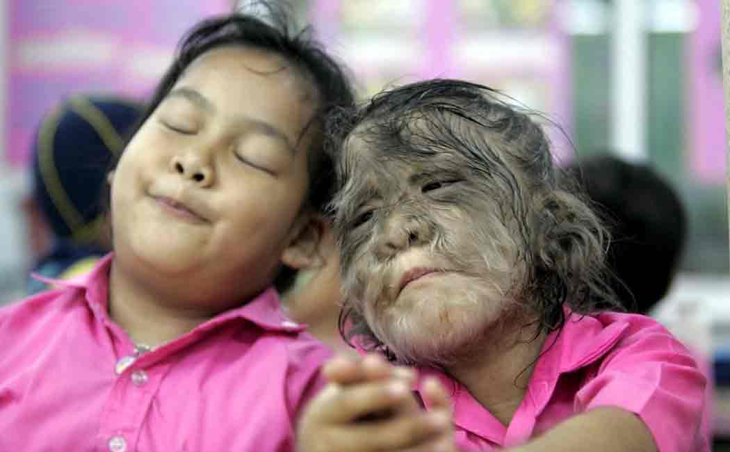 werewolf syndrome in spain